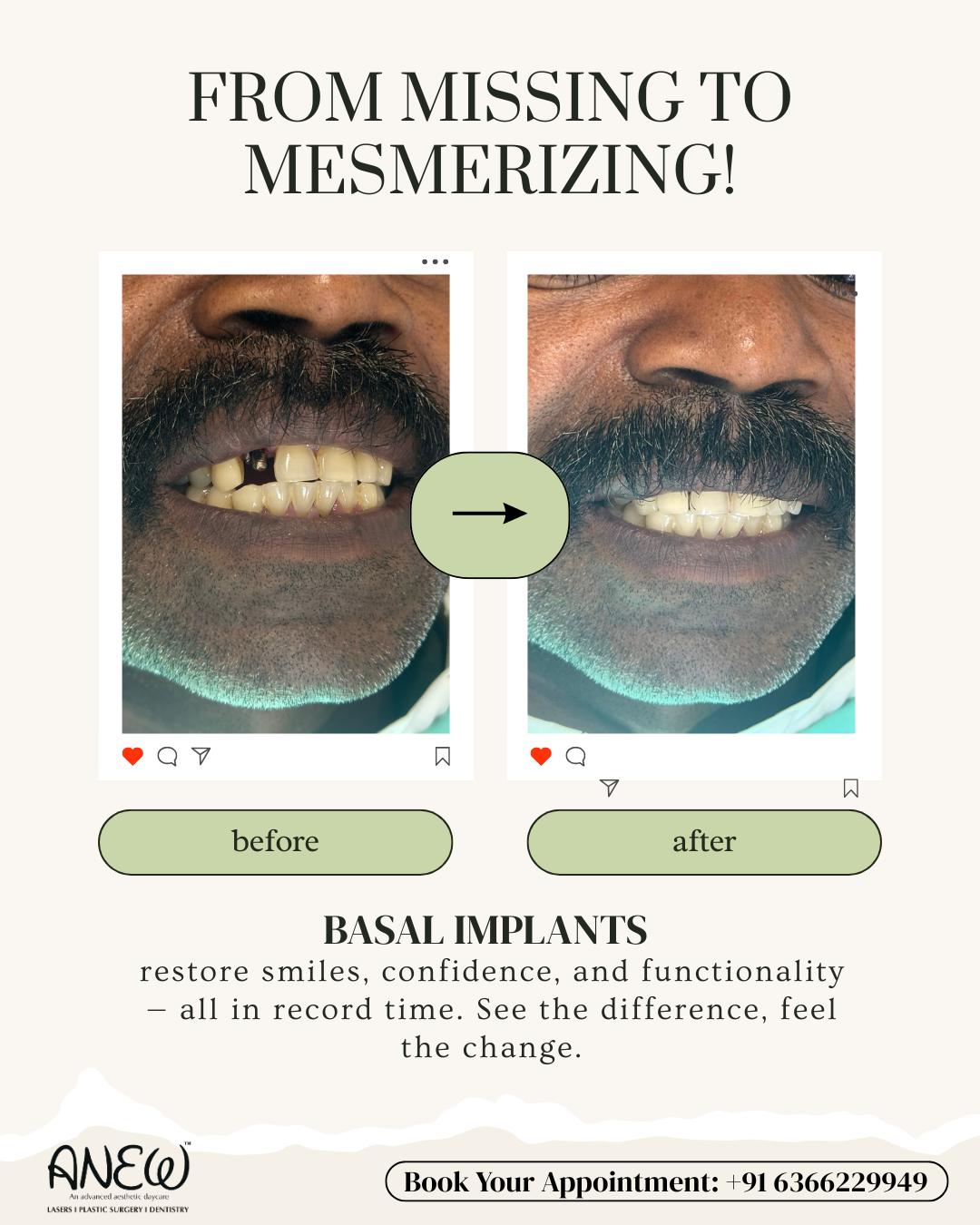 Before and After image